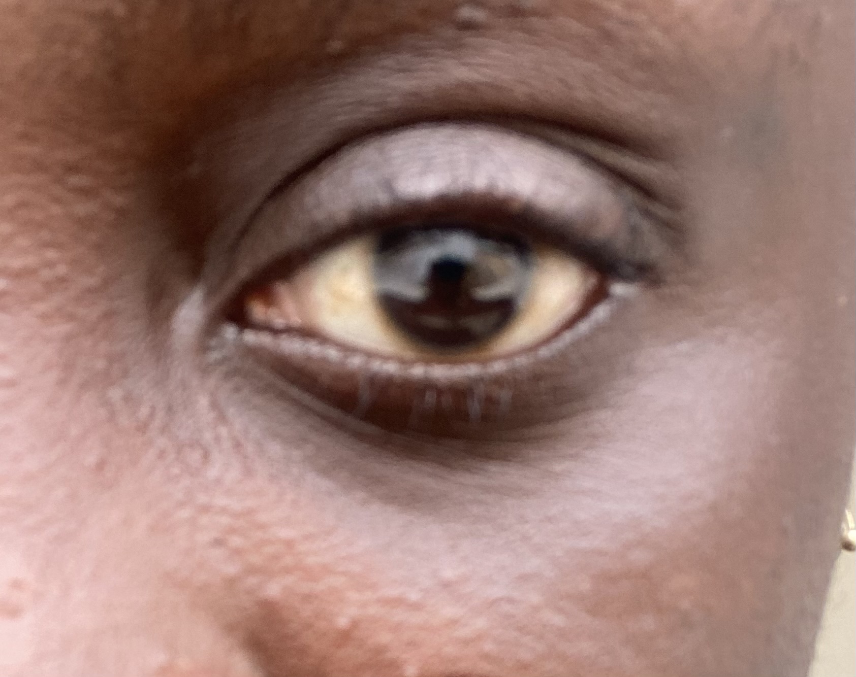 Sample eye image showing proper positioning with visible pupil
